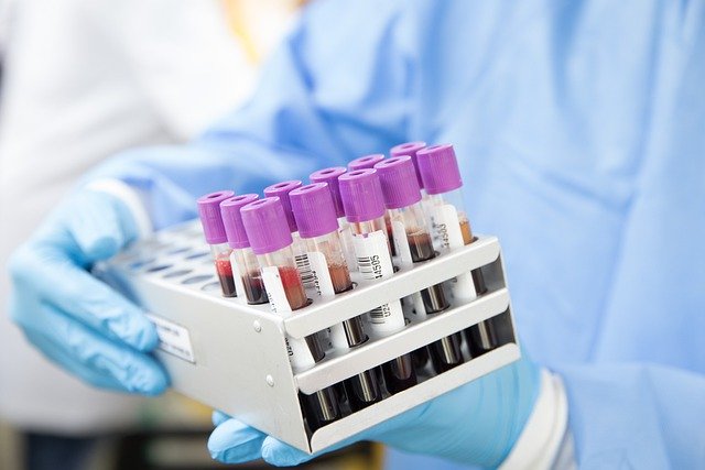 Images of blood tests in a lab