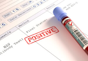 Image concept with the result of the HIV test.